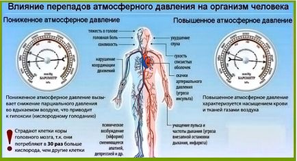 Meteopatiya причинява симптоми, лечение