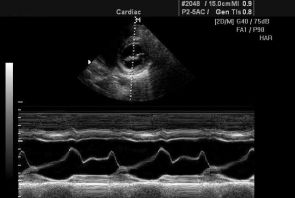 Setarea vizualizării aparatului cu ultrasunete