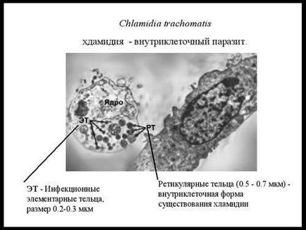 Nu vom fi familiarizați - chlamydia! 1