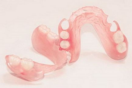 Недорогі знімні зубні протези в СЗАТ Москви