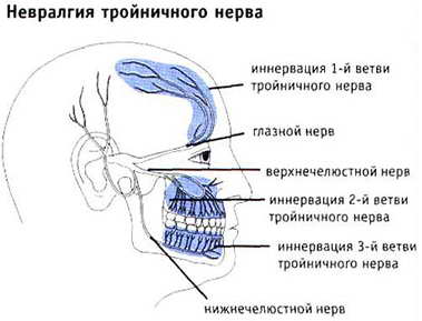 Nevrită a tratamentului nervului facial - frumos la modă