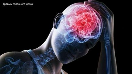 Edemul creierului cu traumatisme după efectele edemelor
