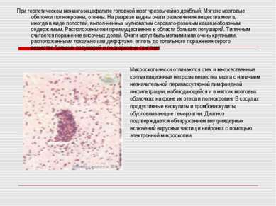 Prezentare - Herpes simplex - descărcare gratuită