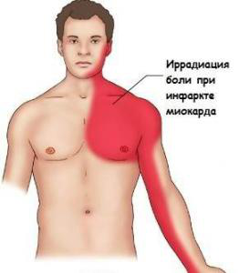 Simptomele unui atac de cord la bărbați