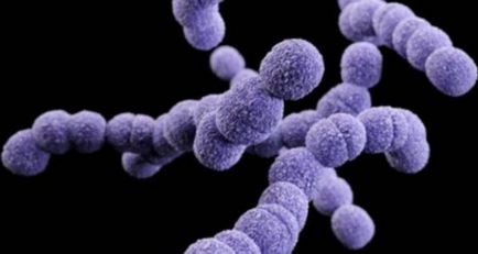 Streptococcus simptome de infecție la adulți, simptome în fotografie corporală