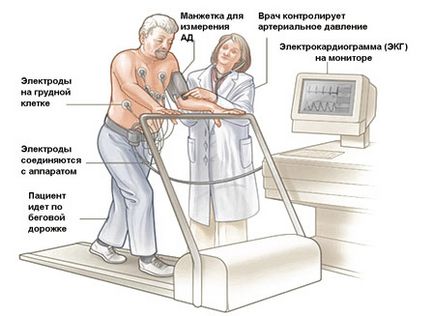 Testarea benzii de alergare (treadmill), mărturia și rezultatele