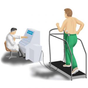 Testarea benzii de alergare (treadmill), mărturia și rezultatele