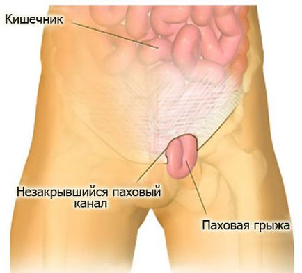 Eliminarea unei hernie în Perm unde se poate efectua o intervenție chirurgicală la o gamă largă de centre medicale, policlinici și