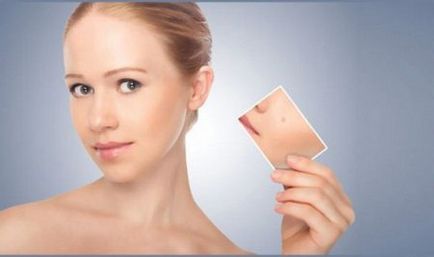 Eliminarea tumorilor pielii - multe metode eficiente