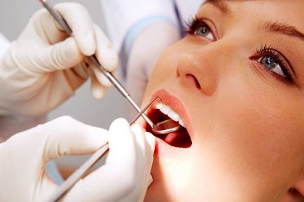 Видалення зубного каменю ультразвуком або лазером - ціни, відгуки
