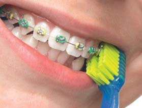 Îngrijirea dinților cu brațe - medicul dentist de familie