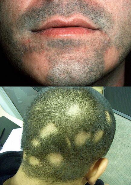 Волосся випадає на ногах у чоловіків ознаки, причини, лікування, профілактика, як зупинити, світла