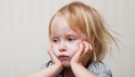 Constipație la copii de 3 ani Komarovsky, tratamentul stupilor