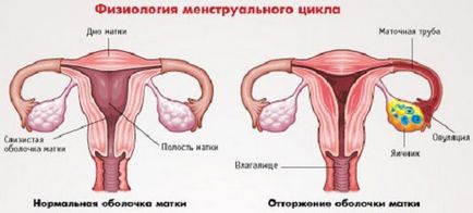 Amenoreea - simptome, tratament, cauze și semne timpurii