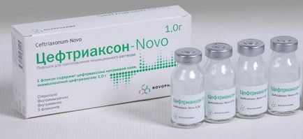 Bakteriális vaginosis okok, tünetek, kezelés (tünetek) Bakteriális vaginosis okok, tünetek, kezelés