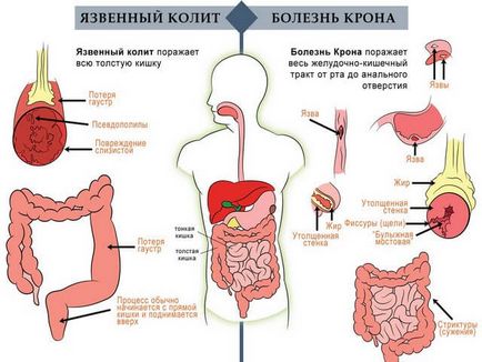 Болить внизу живота у чоловіків причини і що робити