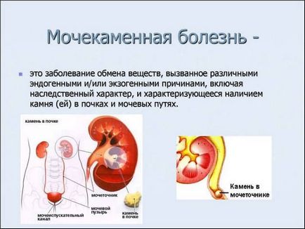 Болить внизу живота у чоловіків причини і що робити