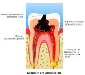 Ce se poate face daca dintele doare