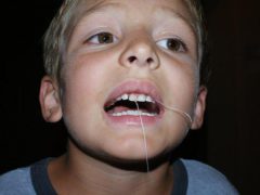 Ce să faci cu un dinte căzut de copil