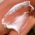 Mi köze hólyagok a égések (természetes összetevőket) Mi köze hólyagok égéstől