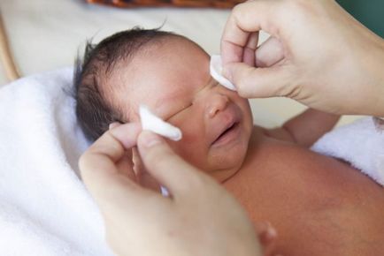 Дакріоцистит у новонароджених лікування, причини, симптоми