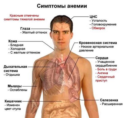 Дієта при залізодефіцитній анемії продукти харчування і меню для дорослих