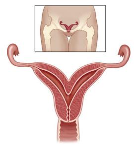 Duplicate gemene uterine de sarcină, sarcini multiple