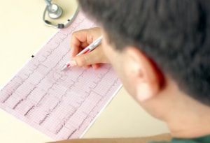 ECG (electrocardiografie)