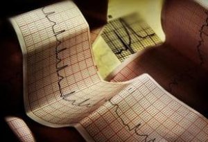 ECG (electrocardiografie)