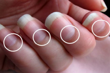 Чи є у вас так званий «півмісяць» на нігтях дізнайтеся, про що це свідчить - корисні