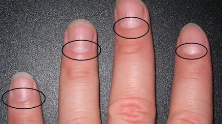 Чи є у вас так званий «півмісяць» на нігтях дізнайтеся, про що це свідчить - корисні