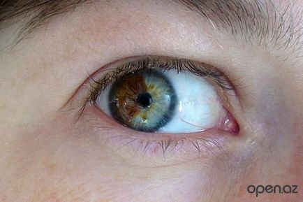 Heterochromia este un univers trickster de buzunar fără nume
