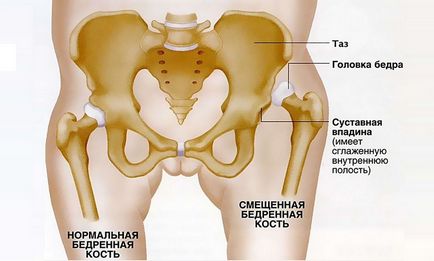 Hipoplazia articulațiilor la copii, cauze, simptome, tratament, prevenire