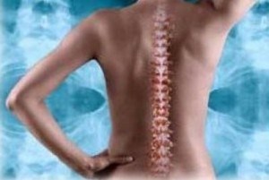 Herniated cauze de disc, simptome, tratamentul herniei lombare și de col uterin