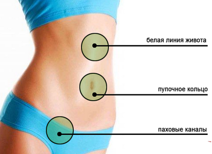 Herniile simptomelor peretelui abdominal anterior, complicații, tratament