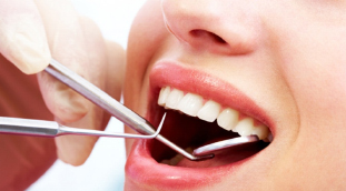 Protezele care sunt mai bune pentru absența completă și parțială a dinților