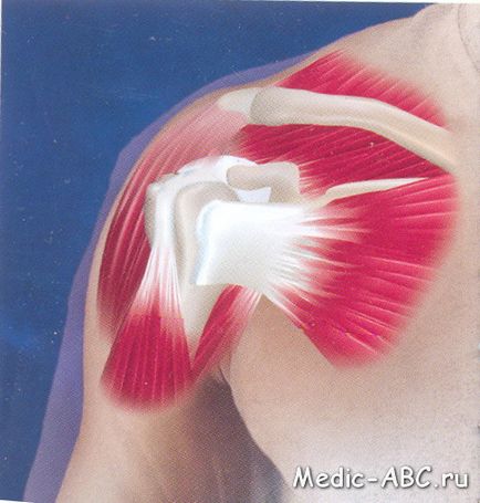 Як лікувати суглоби плеча