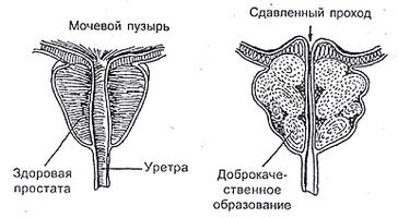 Як правильно почати ефективне лікування хрон