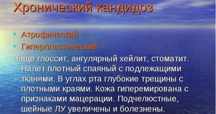 Кандидоз при вич - як довго живуть з молочницею при СНІДі