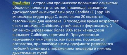 Candidoza cu HIV - cât timp trăiesc cu boala la SIDA