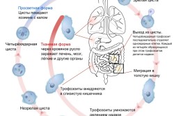 Лікування дизентерії в домашніх умовах