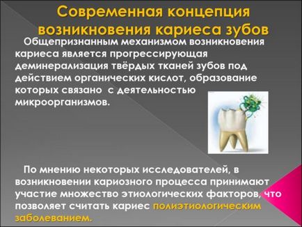 Лікування прикореневого карієсу - діагностика, терапія, профілактика