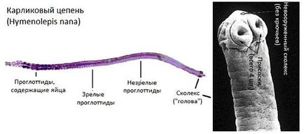 Bandă de vierme - tipuri de cale de infecție, simptome și tratament