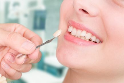 Люмініри - ціна на 1 зуб в москві, відгуки пацієнтів, фото