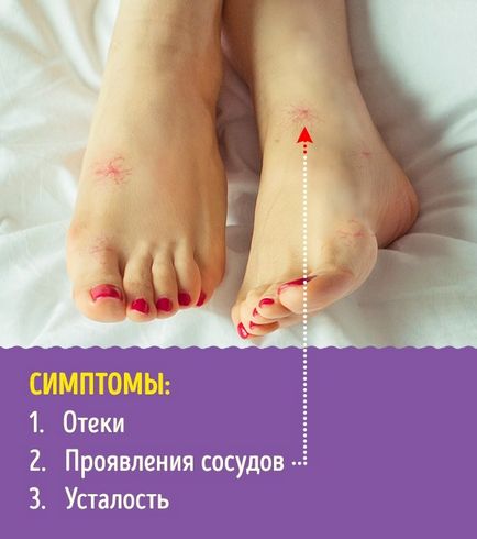 Medicii au numit semnele principale ale bolilor grave care se manifestă pe picioare