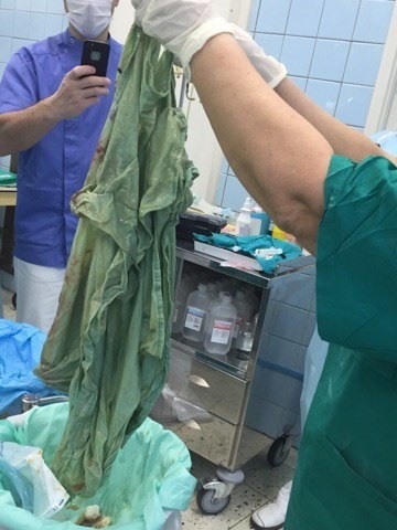Ministerul Sănătății a preluat controlul asupra cazului cu o foaie uitată în abdomenul matern al femeii