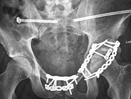 Tomografia computerizată multispirală este centrul medicinei de familie 