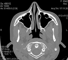 Tomografia computerizată multispirală este centrul medicinei de familie 