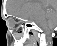 Tomografia computerizată multispirală este centrul medicinei de familie 