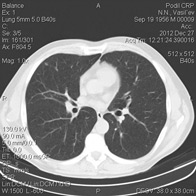 Tomografia computerizată multispirală este centrul medicinei de familie 